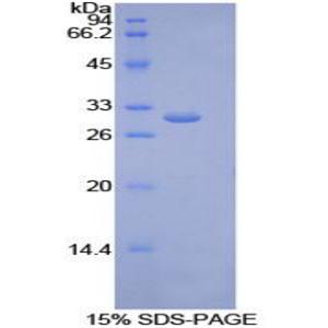 内皮脂肪酶(LIPG)重组蛋白,Recombinant Lipase, Endothelial (LIPG)