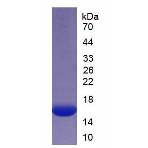 内皮素转化酶2(ECE2)重组蛋白