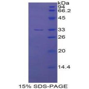 内皮素转化酶1(ECE1)重组蛋白,Recombinant Endothelin Converting Enzyme 1 (ECE1)