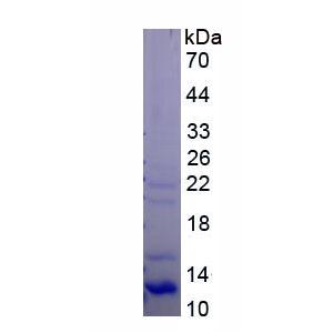 内皮素受体A(ETRA)重组蛋白
