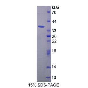 耐扭蛋白1A(TOR1A)重组蛋白