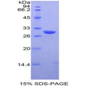 膜突蛋白(MSN)重组蛋白