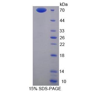 膜联蛋白A9(ANXA9)重组蛋白