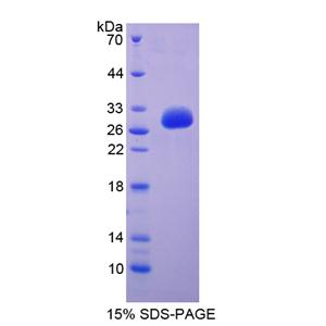 免疫球蛋白超家族成员2(IGSF2)重组蛋白