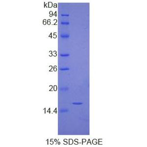 免疫球蛋白G4(IgG4)重组蛋白,Recombinant Immunoglobulin G4 (IgG4)