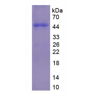 免疫球蛋白D(IgD)重组蛋白