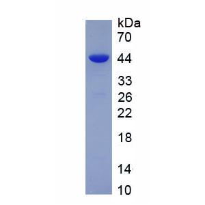 免疫球蛋白A1(IgA1)重组蛋白