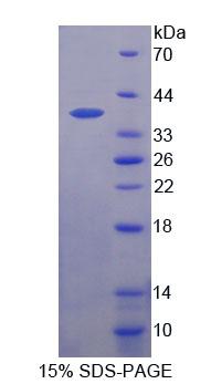 錨定蛋白重復(fù)域蛋白1(ANKRD1)重組蛋白,Recombinant Ankyrin Repeat Domain Protein 1 (ANKRD1)