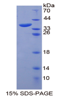 锚定蛋白1(ANK1)重组蛋白,Recombinant Ankyrin 1, Erythrocytic (ANK1)