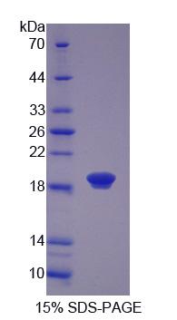 毛狀樣蛋白1(COTL1)重組蛋白,Recombinant Coactosin Like Protein 1 (COTL1)