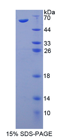 毛细血管扩张性共济失调突变因子(ATM)重组蛋白,Recombinant Ataxia Telangiectasia Mutated (ATM)