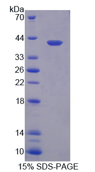 慢型肌球蛋白结合蛋白C(MYBPC1)重组蛋白,Recombinant Myosin Binding Protein C, Slow Type (MYBPC1)