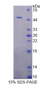 慢肌肌钙蛋白C(TNNC1)重组蛋白,Recombinant Troponin C Type 1, Slow (TNNC1)