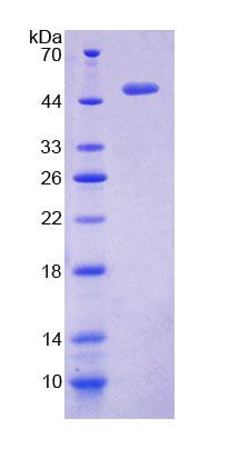 脉周蛋白1(PPHLN1)重组蛋白,Recombinant Periphilin 1 (PPHLN1)