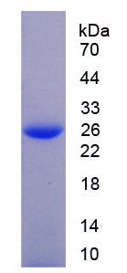 氯化物细胞内通道蛋白1(CLIC1)重组蛋白,Recombinant Chloride Intracellular Channel Protein 1 (CLIC1)