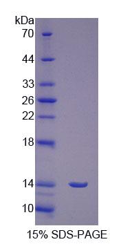 卵泡刺激素受體(FSHR)重組蛋白,Recombinant Follicle Stimulating Hormone Receptor (FSHR)