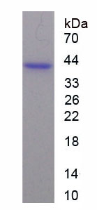 卵巢肿瘤蛋白1(OTUB1)重组蛋白,Recombinant Otubain 1 (OTUB1)