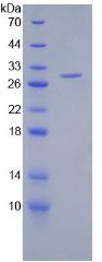 硫酸肝素蛋白聚糖2(HSPG2)重组蛋白,Recombinant Heparan Sulfate Proteoglycan 2 (HSPG2)