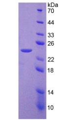 磷酸烯醇式丙酮酸羧激酶2(PCK2)重組蛋白,Recombinant Phosphoenolpyruvate Carboxykinase 2, Mitochondrial (PCK2)