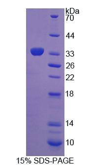 淋巴细胞特异性蛋白1(LSP1)重组蛋白,Recombinant Lymphocyte Specific Protein 1 (LSP1)