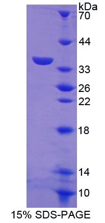 淋巴細(xì)胞抗原75(LY75)重組蛋白,Recombinant Lymphocyte Antigen 75 (LY75)