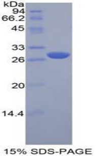 淋巴细胞激活基因3(LAG3)重组蛋白,Recombinant Lymphocyte Activation Gene 3 (LAG3)