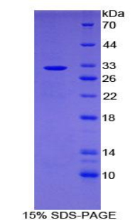 亮氨酸丰富重复免疫球蛋白样域蛋白1(LRIG1)重组蛋白,Recombinant Leucine Rich Repeats And Immunoglobulin Like Domains Protein 1 (LRIG1)