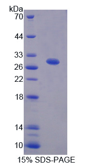 亮氨酸丰富重复激酶2(LRRK2)重组蛋白,Recombinant Leucine Rich Repeat Kinase 2 (LRRK2)