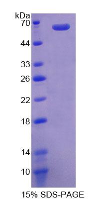 聯(lián)會蛋白(GMNN)重組蛋白,Recombinant Geminin (GMNN)