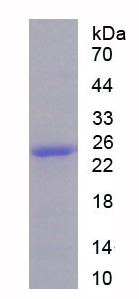 连接桥粒斑珠蛋白(JUP)重组蛋白,Recombinant Junction Plakoglobin (JUP)