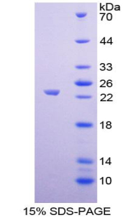 連接附著分子2(JAM2)重組蛋白,Recombinant Junctional Adhesion Molecule 2 (JAM2)