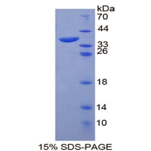 锚定蛋白1(ANK1)重组蛋白,Recombinant Ankyrin 1, Erythrocytic (ANK1)