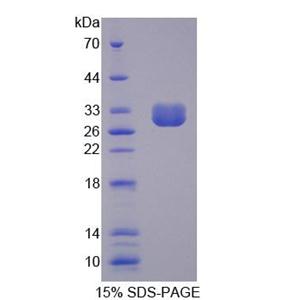 氯离子通道辅助蛋白1(CLCA1)重组蛋白