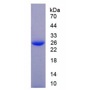 氯化物细胞内通道蛋白1(CLIC1)重组蛋白