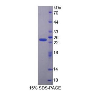 鳞状细胞癌抗原1/2(SCCA1/SCCA2)重组蛋白