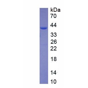磷酸二酯酶5A(PDE5A)重组蛋白