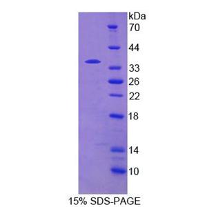 磷酸二酯酶4B(PDE4B)重组蛋白,Recombinant Phosphodiesterase 4B, cAMP Specific (PDE4B)