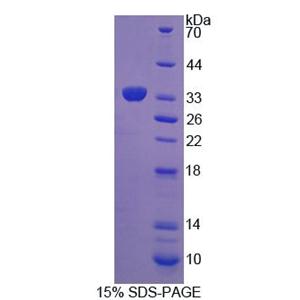 淋巴细胞特异性蛋白1(LSP1)重组蛋白