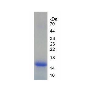 淋巴细胞抗原96(LY96)重组蛋白