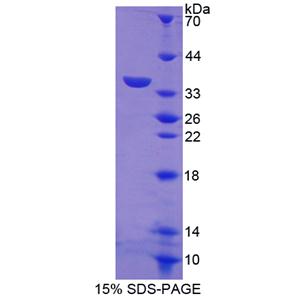 淋巴细胞抗原75(LY75)重组蛋白