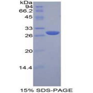 淋巴细胞激活基因3(LAG3)重组蛋白