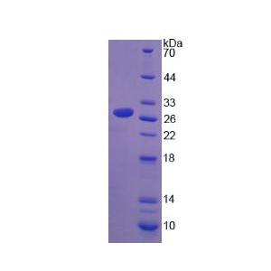淋巴细胞胞浆蛋白1(LCP1)重组蛋白