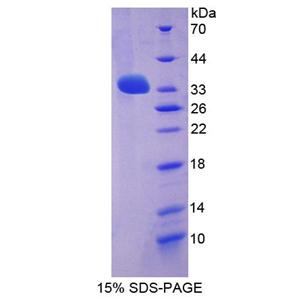 亮氨酸丰富重复LGI家族成员3(LGI3)重组蛋白