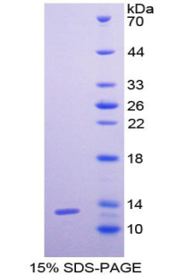 粒细胞趋化蛋白2(GCP2)重组蛋白,Recombinant Granulocyte Chemotactic Protein 2 (GCP2)