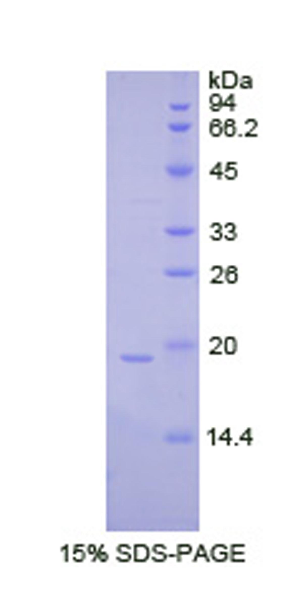 粒细胞集落刺激因子(GCSF)重组蛋白,Recombinant Colony Stimulating Factor 3, Granulocyte (GCSF)