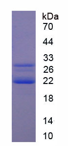 冷诱导RNA结合蛋白(CIRBP)重组蛋白,Recombinant Cold Inducible RNA Binding Protein (CIRBP)