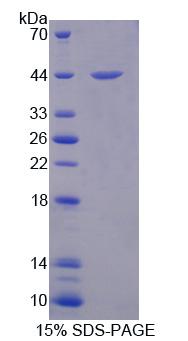 类固醇硫酸酯酶同工酶S(STS)重组蛋白,Recombinant Steroid Sulfatase Isozyme S (STS)