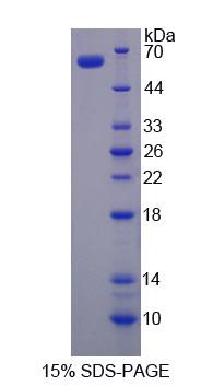 類固醇合成急性調(diào)節(jié)蛋白(STAR)重組蛋白,Recombinant Steroidogenic Acute Regulatory Protein (STAR)