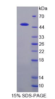 酪蛋白κ(CSN3)重組蛋白,Recombinant Casein Kappa (CSN3)