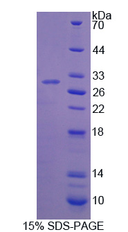 酪氨酸羥化酶(TH)重組蛋白,Recombinant Tyrosine Hydroxylase (TH)